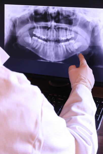 Best Emergency Broken Tooth Repair in Minooka, IL